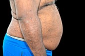 Overweight man's abdomen