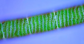 Spirogyra green algae, light micrograph