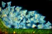 Vorticella protozoa, polarised light micrograph