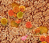 Nasal epithelium and pollen, SEM