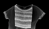 Intricate top, X-ray