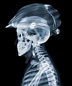 Rider with cycle helmet, X-ray