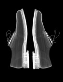 Shoes, X-ray