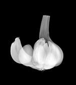 Garlic bulb, X-ray