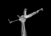 Arm holding a machine gun, X-ray