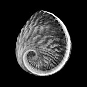 Pearl oyster shell, X-ray