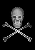 Skull and crossbones, X-ray