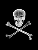 Skull and crossbones, X-ray