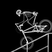 Skeleton bike stunt, X-ray