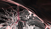 Lungs affected by Covid-19, 3D CT scan