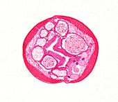 Giant roundworm male, light micrograph