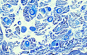 Trichinella parasite in polar bear muscle, light micrograph