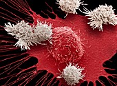 T-cells and breast cancer cell, SEM