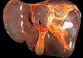 Human liver and gallbladder