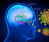 Loss of smell in Covid-19, illustration