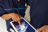 Close up doctors examining digital x-ray on tablet