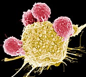 T lymphocytes and cancer cell, SEM