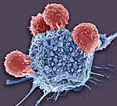 T lymphocytes and cancer cell, SEM