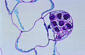 Fern male sex organ, light micrograph