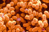 Brevibacterium linens bacteria, SEM