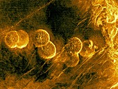 Alpha Regio, Venus, radar image