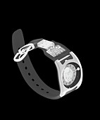 Wrist watch, X-ray