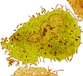 Leukaemia cell, TEM