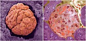 Glomerulus, SEM-TEM comparison