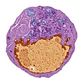Hybridoma cell, TEM