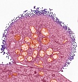 Vesicular stomatitis virus, TEM