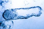 Transmission Electron Microscopy (TEM) of Clostridium botulinum Bacteria