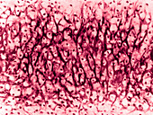 Cartilage from Epiglottis, LM