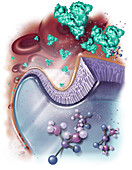 Cisplatin and Hemodialysis, Illustration