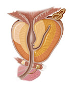 Lateral View of Prostate, Illustration