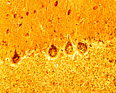 Purkinje Neurons, Golgi Apparatus, LM