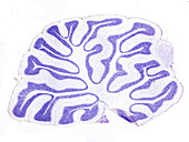 Cerebellum, Sagittal Section