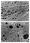 Cytoskeleton of Tissue Culture Cells