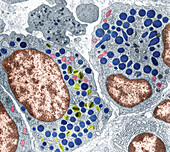 Myelocytes in Bone Marrow, TEM