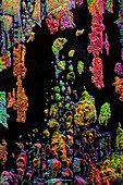 Vitamin B3, Polarized and Dark Field Micrograph