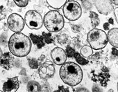 Chlamydia Bacteria (TEM)