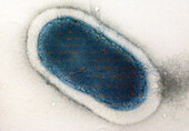 Klebsiella pneumoniae Bacteria , TEM