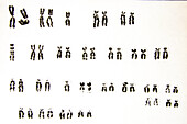 Karyotype, Owl Monkey (Aotus trivirgatus)