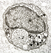 Megakaryocyte, EM