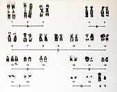 Human Male Karyotype, Trisomy 13