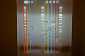 Gel Electrophoresis Patterns of TB