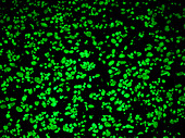 Potato Starch Grains in Cells