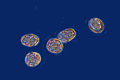 Brucella bacteria, LM