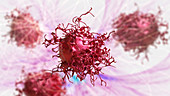 Cervical cancer cells, illustration