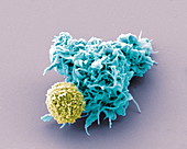 Dendritic cell and lymphocyte, SEM