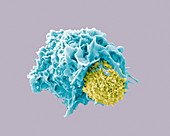 Dendritic cell and lymphocyte, SEM